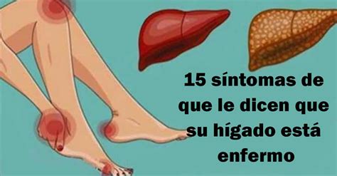 Sintomas De Higado Enfermo