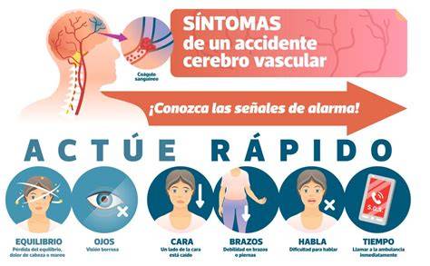 Sintomas De Un Derrame Cerebral