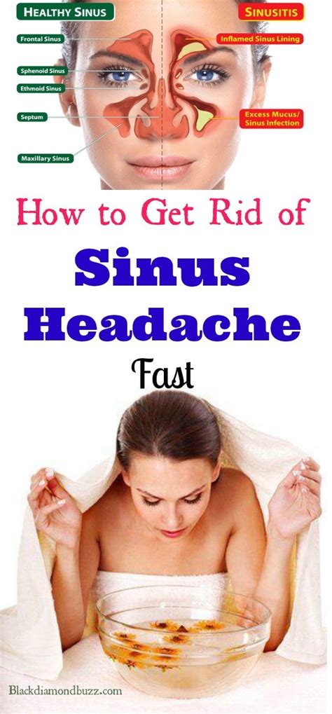Sinus Headache Remedy