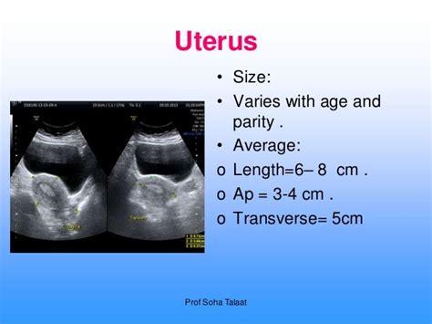 Size Uterus Normal