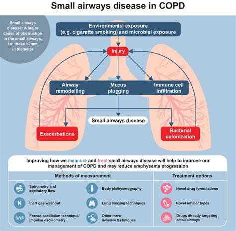 Small Airway Disease