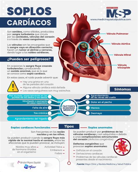 Soplo En El Corazon