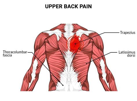 Sore Back Upper Left Side