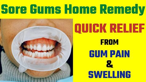 Sore Gums Home Remedy