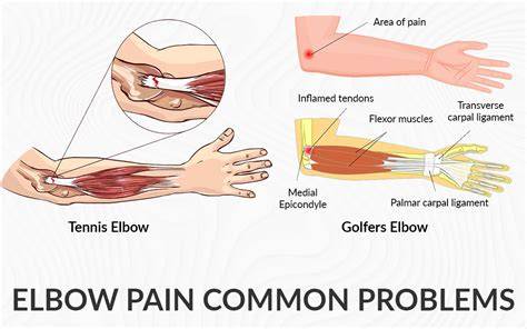 Sore Left Elbow Joint