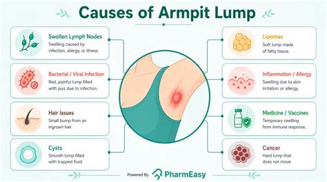 Sore Lump Under Armpit