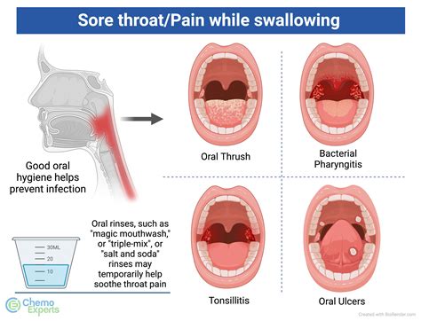 Sore Throat And Ears