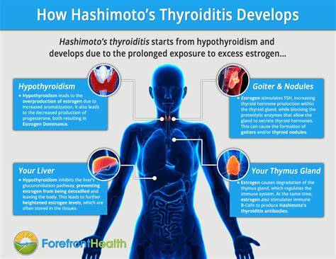 Specialist In Hashimoto's Thyroiditis