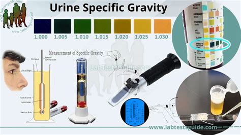 Specific Gravity Of Urine