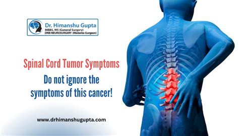 Spinal Cancer Symptoms