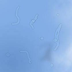 Squiggly Lines In Vision