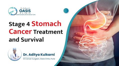 Stage 4 Stomach Cancer