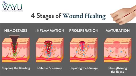 Stages Of Healing