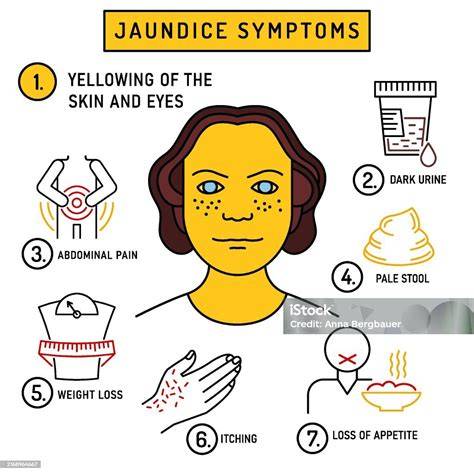 Stages Of Jaundice In Adults