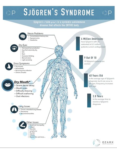 Stages Of Sjogren's Disease Life Expectancy