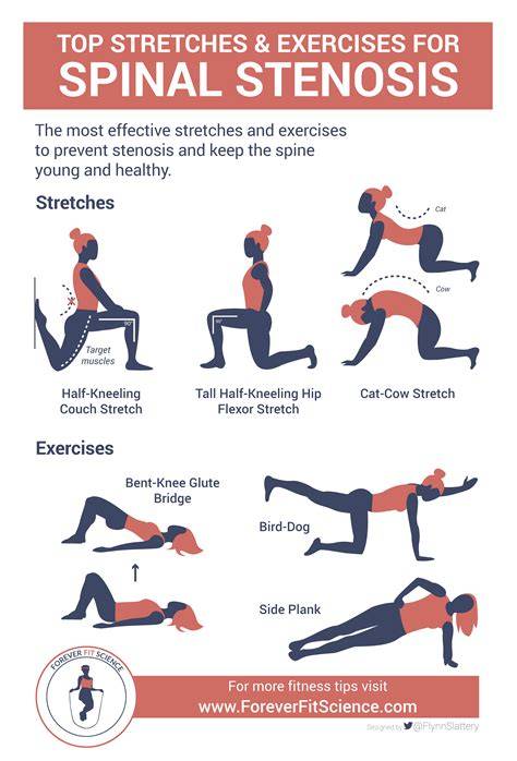 Stenosis Back Pain Relief