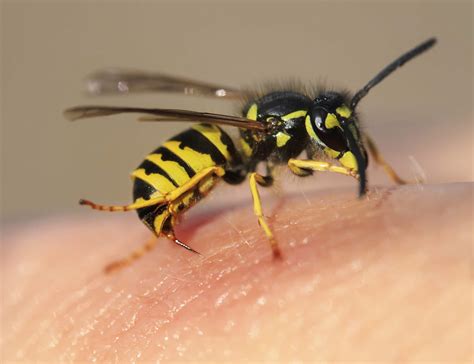Sting Of A Bee