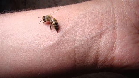 Sting Of Bee