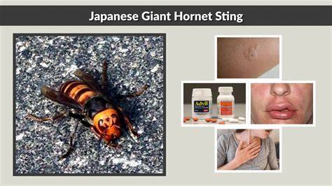 Sting Of Hornet