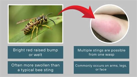 Sting Of Yellow Wasp