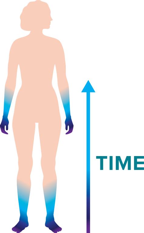 Stocking Glove Neuropathy