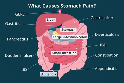 Stomach Pain Top Of Stomach