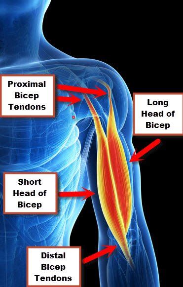 Strained Muscle In Bicep