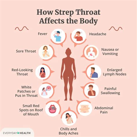 Strep Throat In Early Stage