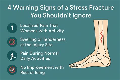 Stress Fracture Signs Symptoms
