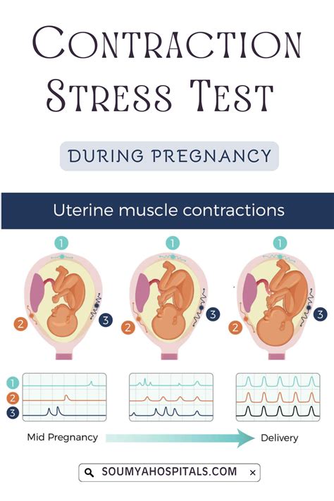 Stress Test Pregnancy