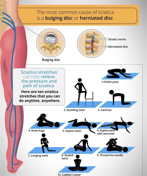 Stretches For Bulging Disk