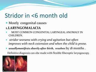 Stridor In Babies