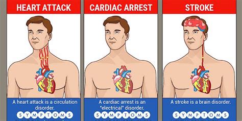 Stroke Vs Heart Attack