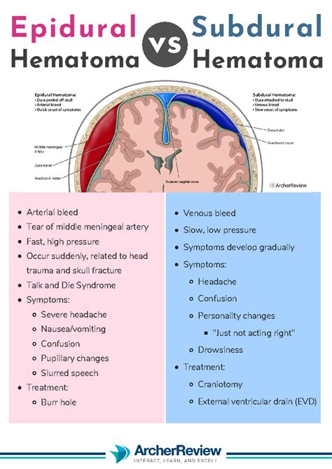 Subdural Hematoma Vs Epidural Hematoma