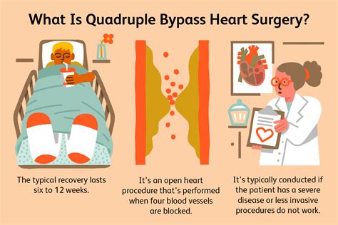 Success Rate Of Quadruple Bypass