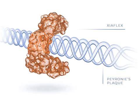 Success Rate Of Xiaflex