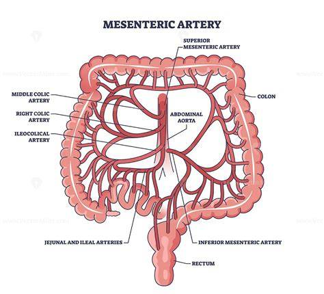 Superior Mesenteric Artery Stenosis