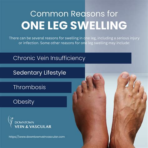Swelling In One Leg