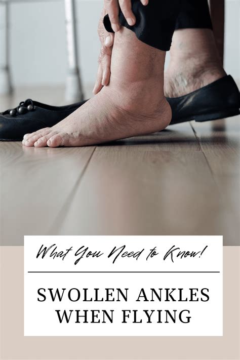 Swollen Ankles After Flight
