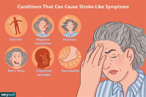 Symptoms Of A Mini Stroke