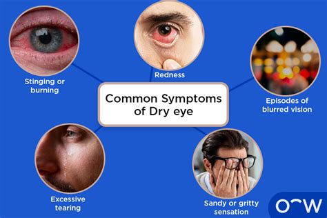 Symptoms Of Dry Eyes