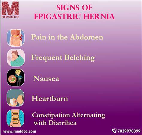Symptoms Of Epigastric Hernias