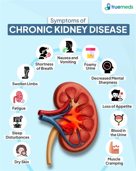 Symptoms Of Failed Kidney