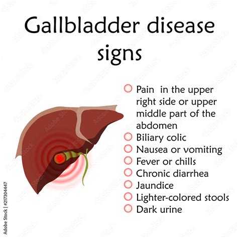 Symptoms Of Gallbladder Attack