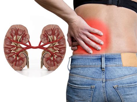 Symptoms Of Kidney Damage