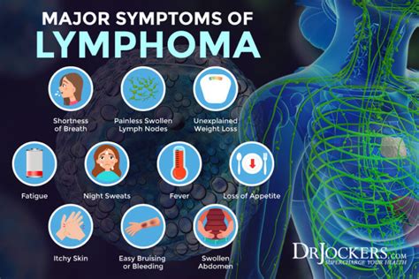 Symptoms Of Lymphoma In Females
