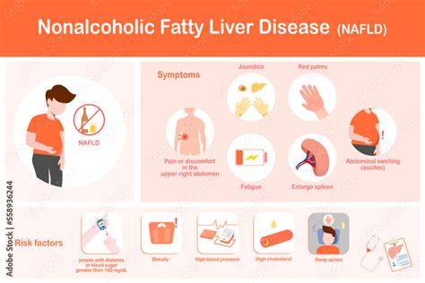 Symptoms Of Nafld