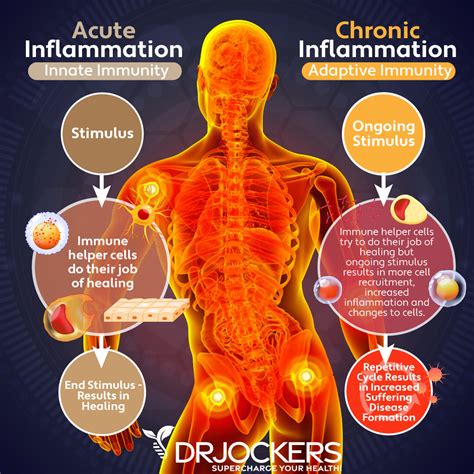 Symptoms Of Stressinduced Inflammation