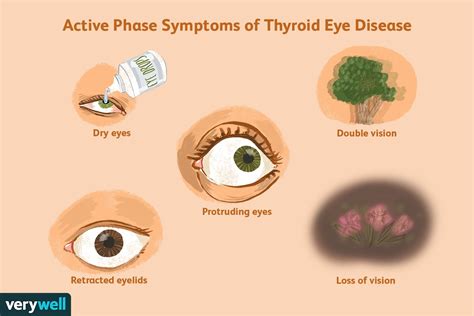 Symptoms Of Ted