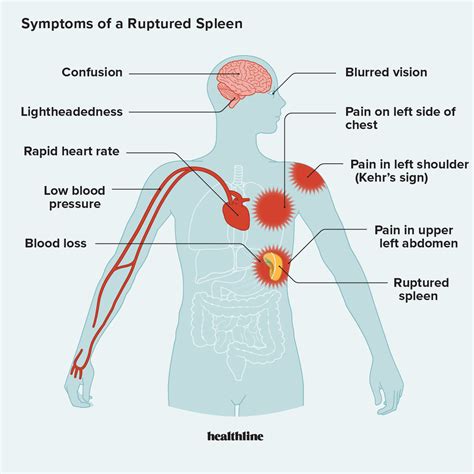 Symptoms Of Weak Spleen